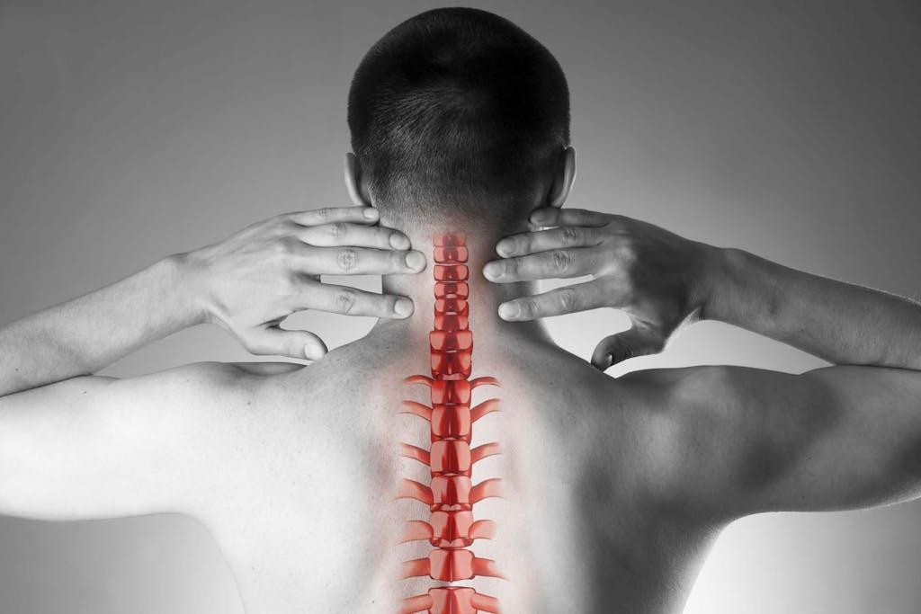 Herniated Disc in the Neck — Diagnosis of Cervical Disc Herniation