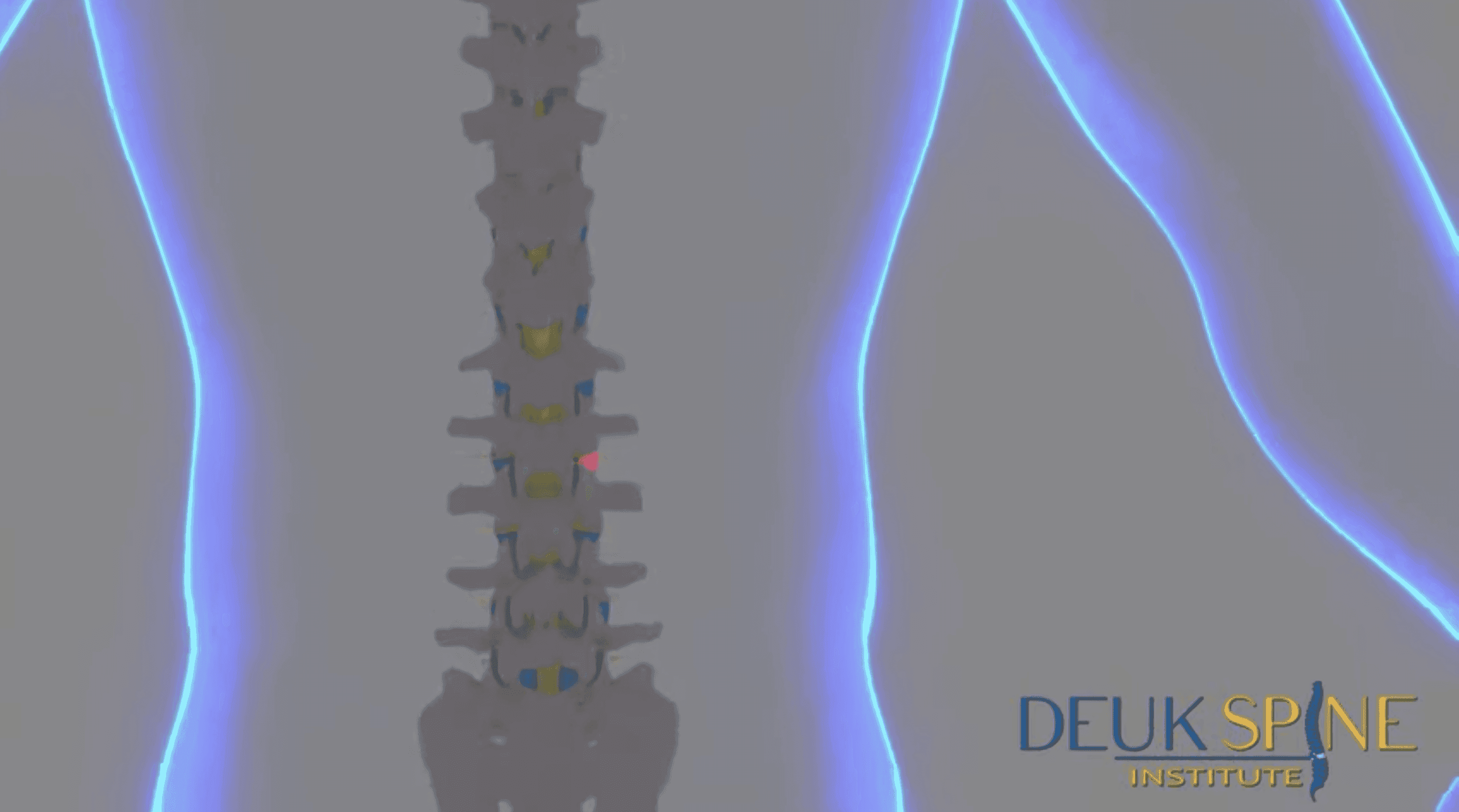 Herniated Disc Surgery: Types, Recovery Time, Risks and Benefits for Back Pain